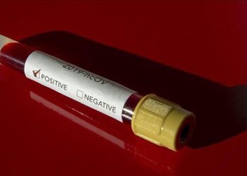 Srbija: Dvije osobe preminule od koronavirusa