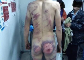 BRUTALNOST HRVATSKE POLICIJE NAD MIGRANTIMA DOSEGLA VRHUNAC