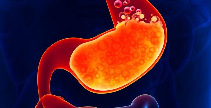 DVA MOĆNA NAPITKA ZA ŽELUDAČNU KISELINU: RIJEŠITE SE GORUŠICE PREKO NOĆI!