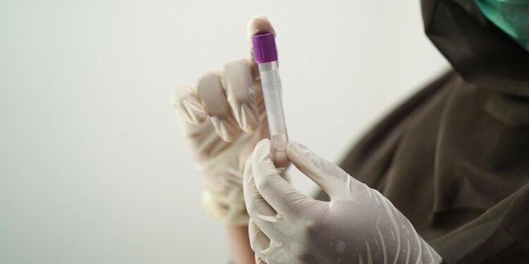 Kućni testovi na koronu stigli u apoteke, cijena 1.296 dinara