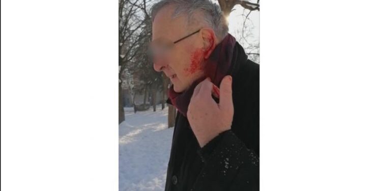 Psi luatlice napali su starijeg čovjeka dok je šetao parkom u Prijepolju