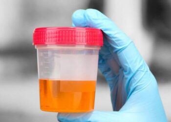 OPREZ, UKOLIKO VAM MOKRAĆA IMA JAK I NEUGODAN MIRIS: DOKTORICA NAVELA CIJELI NIZ RAZLOGA, EVO KAD JE ALARM ZA UZBUNU