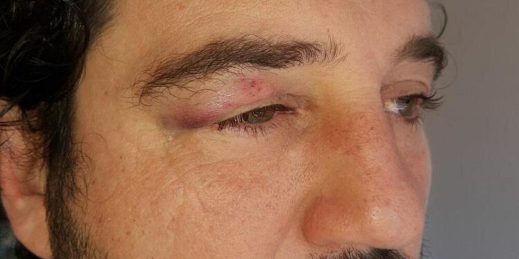 NEVJEROVATNO: U Novom Sadu pretučen glumac jer je u tv seriji gledaocu ubio omiljenog lika