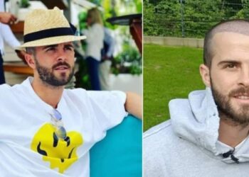 I Miralem Pjanić transplantirao kosu, koliko ovaj zahvat košta?
