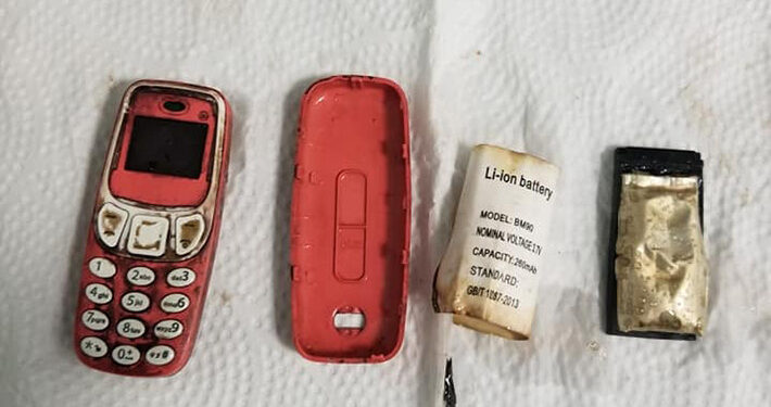 Pacijentu iz stomaka izvadili mobitel: “Baterija je mogla eksplodirati”